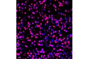 Immunofluorescence of paraffin embedded rat embryonic rat using BRN3A (ABIN7075163) at dilution of 1:650 (400x lens) (POU4F1 anticorps)