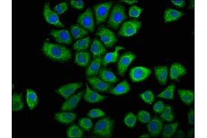 Immunofluorescence staining of Hela cells with ABIN7146664 at 1:66, counter-stained with DAPI. (Caprin-1 anticorps  (AA 573-703))