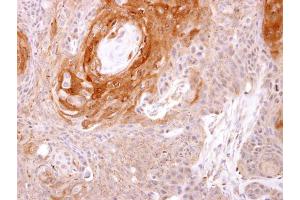 IHC-P Image Prostasin antibody [N1C2] detects Prostasin protein at cytosol on Ca922 xenograft by immunohistochemical analysis. (PRSS8 anticorps  (Center))