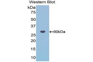 Western Blotting (WB) image for anti-Acidic (Leucine-Rich) Nuclear phosphoprotein 32 Family, Member A (ANP32A) (AA 2-175) antibody (ABIN1077732) (PHAP1 anticorps  (AA 2-175))