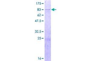 Image no. 1 for Kinesin Family Member 12 (KIF12) (AA 1-513) protein (GST tag) (ABIN7540283)