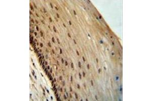 Formalin fixed, paraffin embedded human cervical tissue stained with SPDYE3 Antibody  followed by peroxidase conjugation of the secondary antibody and DAB staining. (SPDYE3 anticorps  (Middle Region))