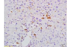Formalin-fixed and paraffin embedded rat liver tissue labeled with Anti- Mannan Binding Lectin Polyclonal Antibody, Unconjugated (ABIN731663) at 1:200, followed by conjugation to the secondary antibody and DAB staining.