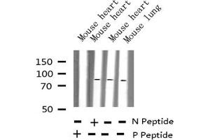 Western blot analysis of Phospho-HSF1 (Ser303) expression in various lysates