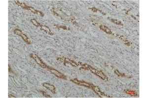 Immunohistochemistry (IHC) analysis of paraffin-embedded Human Kidney Tissue using IkappaB beta Mouse Monoclonal Antibody diluted at 1:200. (NFKBIB anticorps)