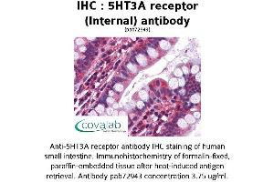 Image no. 1 for anti-Serotonin Receptor 3A (HTR3A) (Internal Region) antibody (ABIN1731371) (Serotonin Receptor 3A anticorps  (Internal Region))