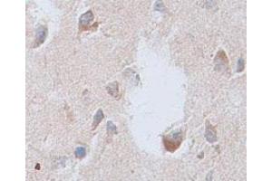 Immunohistochemical staining of formalin-fixed paraffin-embedded human brain tissue showing membrane staining with CNTFR polyclonal antibody  at 1 : 100 dilution. (CNTF Receptor alpha anticorps  (Internal Region))