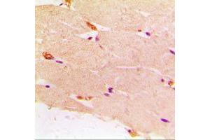 Immunohistochemical analysis of Desmin staining in human muscle formalin fixed paraffin embedded tissue section. (Desmin anticorps  (C-Term))