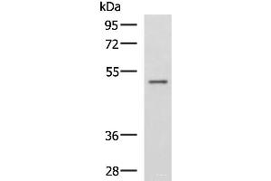 Western blot analysis of Human placenta tissue lysate using GRWD1 Polyclonal Antibody at dilution of 1:800 (GRWD1 anticorps)