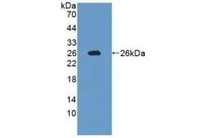 Detection of Recombinant IL12A, Rat using Polyclonal Antibody to Interleukin 12A (IL12A) (IL12A anticorps  (AA 23-215))