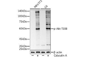 Western blot analysis of extracts of various cell lines, using Phospho-Akt-T308 antibody (ABIN7271240) at 1:1000 dilution. (AKT1 anticorps  (pThr308))