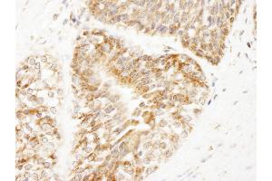 Immunohistochemistry (IHC) image for anti-A Kinase (PRKA) Anchor Protein 1 (AKAP1) (AA 375-425) antibody (ABIN7448928) (AKAP1 anticorps  (AA 375-425))