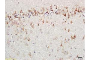 Formalin-fixed and paraffin embedded labeled with rat brain Anti-AMBRA1 Polyclonal Antibody, Unconjugated 1:200 followed by conjugation to the secondary antibody and DAB staining (AMBRA1 anticorps  (AA 221-320))