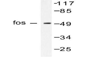 Image no. 1 for anti-c-Fos (c-Fos) antibody (ABIN265423) (c-FOS anticorps)