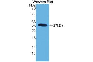 Western blot analysis of the recombinant protein. (Pronociceptin (AA 12-181) anticorps)