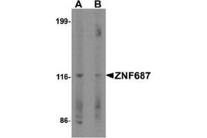 Western blot analysis of ZNF687 in Jurkat cell lysate with ZNF687 Antibody  at 0. (ZNF687 anticorps  (C-Term))