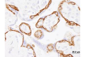 Immunohistochemistry (IHC) image for anti-Epidermal Growth Factor Receptor (EGFR) (C-Term) antibody (ABIN7454624) (EGFR anticorps  (C-Term))