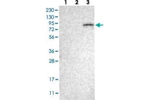 Western Blot (Cell lysate) analysis with ELMO2 polyclonal antibody  Lane 1: Human cell line RT-4 Lane 2: Human cell line U-251MG sp Lane 3: Human plasma (IgG/HSA depleted) (ELMO2 anticorps)