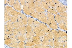 ABIN6258384 and ABIN6274981 at 1/100 staining Rat skin tissue by IHC-P.