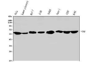 Western blot analysis of nmt55 p54nrb using anti-nmt55 p54nrb antibody (ABIN6719600).