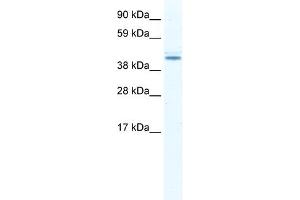 WB Suggested Anti-DDX49 Antibody Titration:  2.
