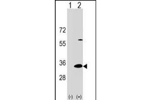 Western blot analysis of DP1 (arrow) using rabbit polyclonal DP1 Antibody (C-term) 17383b.