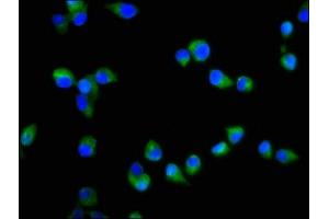 Immunofluorescence staining of SH-SY5Y cells with ABIN7170569 at 1:200, counter-stained with DAPI. (S1PR2 anticorps  (AA 293-353))