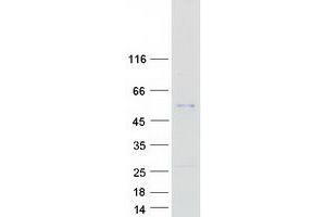 Validation with Western Blot