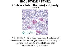 Image no. 1 for anti-Parathyroid Hormone 2 Receptor (PTH2R) (1st Extracellular Domain), (pThr2) antibody (ABIN1738582) (PTH2R anticorps  (1st Extracellular Domain, pThr2))