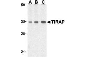 Western blot analysis of TIRAP in human heart cell lysates with this product at (A) 0. (TIRAP anticorps  (C-Term))