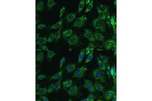 Immunofluorescence analysis of C6 cells using Galectin 3/Galectin 3/LG antibody (ABIN6130437, ABIN6143158, ABIN6143159 and ABIN7101422) at dilution of 1:100.