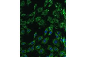 Immunofluorescence analysis of C6 cells using Galectin 3/Galectin 3/LG antibody (ABIN6130437, ABIN6143158, ABIN6143159 and ABIN7101422) at dilution of 1:100. (Galectin 3 anticorps  (AA 1-250))