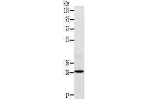 Western Blotting (WB) image for anti-Triggering Receptor Expressed On Myeloid Cells 2 (TREM2) antibody (ABIN2434061) (TREM2 anticorps)