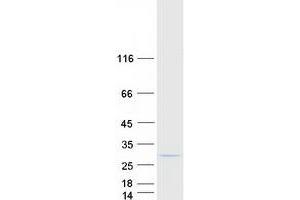 Validation with Western Blot