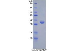 SDS-PAGE analysis of Human GKRP Protein. (GCKR Protéine)