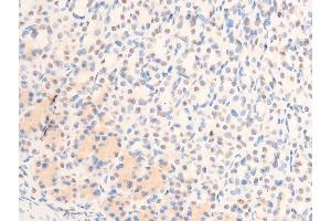 ABIN6267305 at 1/100 staining rat gastric tissue sections by IHC-P. (C-JUN anticorps  (pThr239))