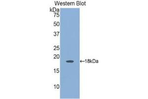 Western blot analysis of the recombinant protein. (Angiopoietin 2 anticorps  (AA 24-165))