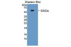Western blot analysis of the recombinant protein. (TNC anticorps  (AA 174-621))