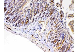 IHC analysis of PPID using anti-PPID antibody .
