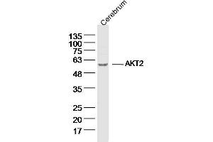Mouse Cerebrum lysates probed with AKT2 Polyclonal Antibody, unconjugated  at 1:300 overnight at 4°C followed by a conjugated secondary antibody for 60 minutes at 37°C. (AKT2 anticorps  (AA 101-200))