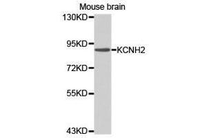 Western Blotting (WB) image for anti-Potassium Voltage-Gated Channel, Subfamily H (Eag-Related), Member 2 (KCNH2) antibody (ABIN1873378) (KCNH2 anticorps)