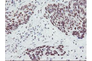 Image no. 5 for anti-SUMO1/sentrin/SMT3 Specific Peptidase 2 (SENP2) (AA 139-523) antibody (ABIN1490925)