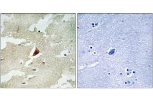 Immunohistochemistry analysis of paraffin-embedded human brain tissue, using MAPKAPK5 Antibody. (MAPKAP Kinase 5 anticorps  (AA 171-220))