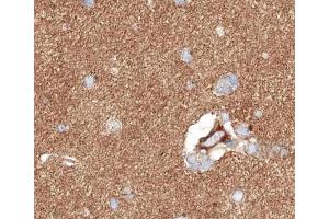 ABIN6266542 at 1/100 staining human brain tissue sections by IHC-P. (GABBR1 anticorps  (C-Term))