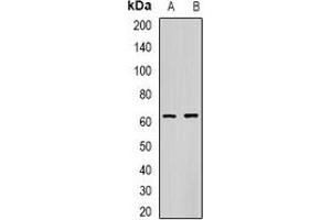 Western blot analysis of CES1 expression in A549 (A), mouse liver (B) whole cell lysates. (CES1 anticorps)