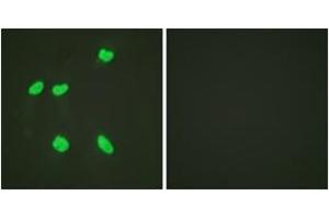 Immunofluorescence analysis of HeLa cells, using Histone H4 (Acetyl-Lys16) Antibody. (Histone H4 anticorps  (acLys16))