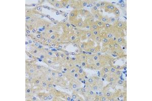 Immunohistochemistry of paraffin-embedded mouse kidney using C antibody (ABIN6129635, ABIN6137807, ABIN6137808 and ABIN6217796) at dilution of 1:100 (40x lens). (CABP7 anticorps  (AA 100-180))