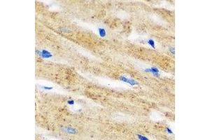 Immunohistochemical analysis of IL-18BP staining in mouse heart formalin fixed paraffin embedded tissue section. (IL18BP anticorps)
