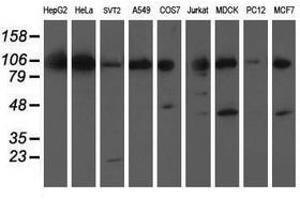 Image no. 2 for anti-Excision Repair Cross-Complementing Rodent Repair Deficiency, Complementation Group 4 (ERCC4) antibody (ABIN1498073) (ERCC4 anticorps)