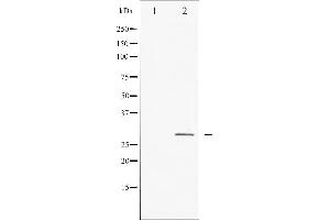 Western blot analysis of HSP27 expression in Ca2+ treated HeLa whole cell lysates,The lane on the left is treated with the antigen-specific peptide. (HSP27 anticorps  (Internal Region))